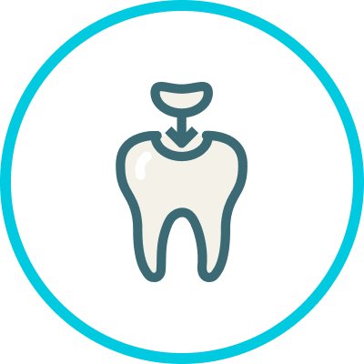 Root Canal Treatment