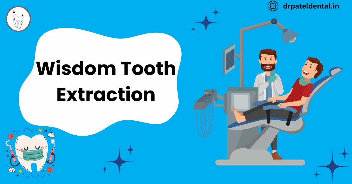 Wisdom Tooth Extraction